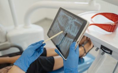 What Factors Affect the Price of Invisalign?
