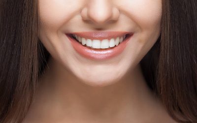 Where Can I Get Safe Dental Implants?
