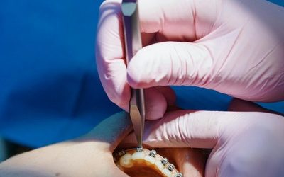 How to Choose the Right Orthodontic Clinic