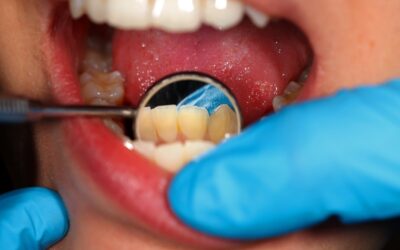 Why Is Preventive Dentistry Important for Oral Health?