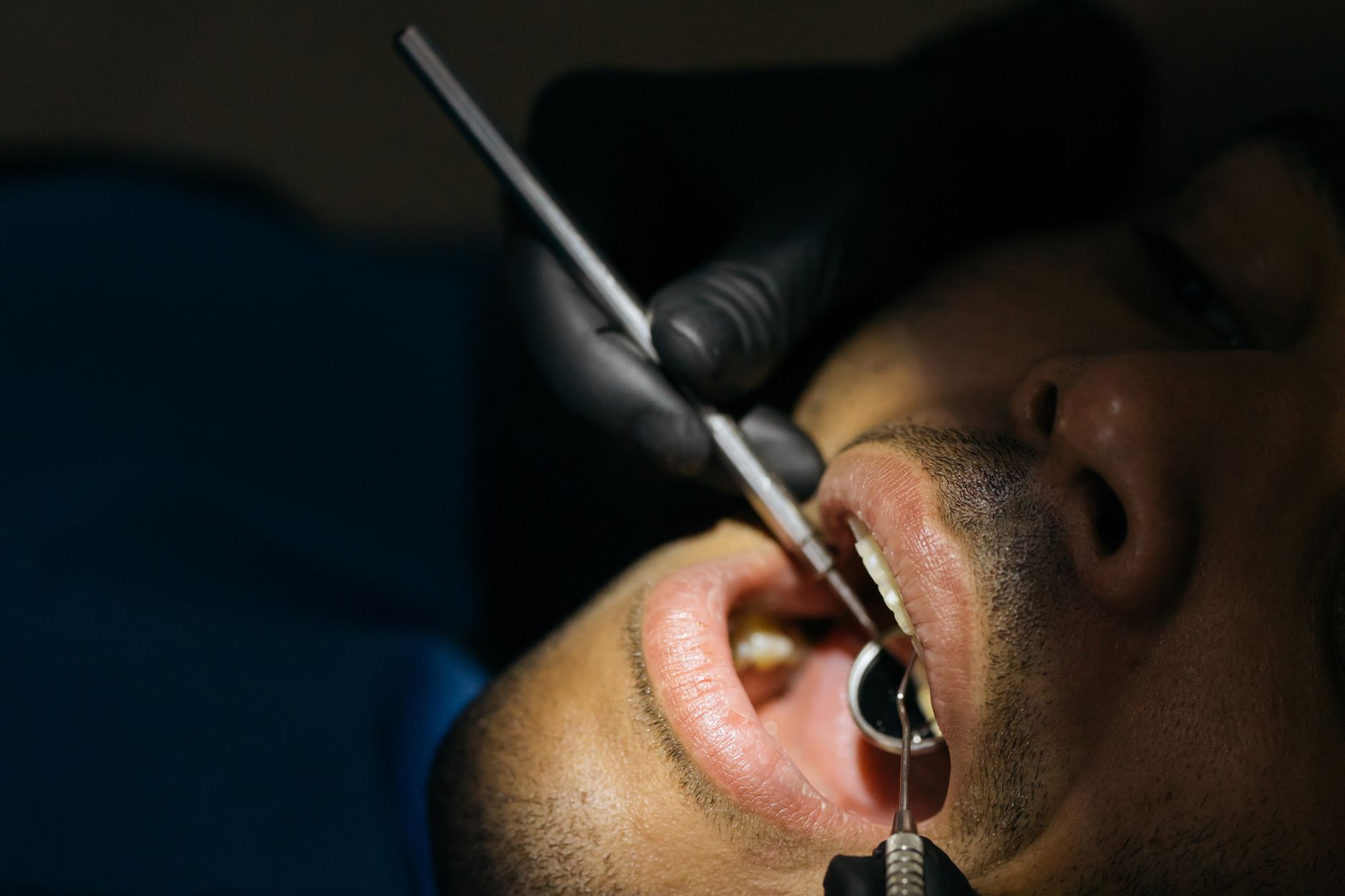 How Often Should You Visit the Dentist? A Guide to Dental Health