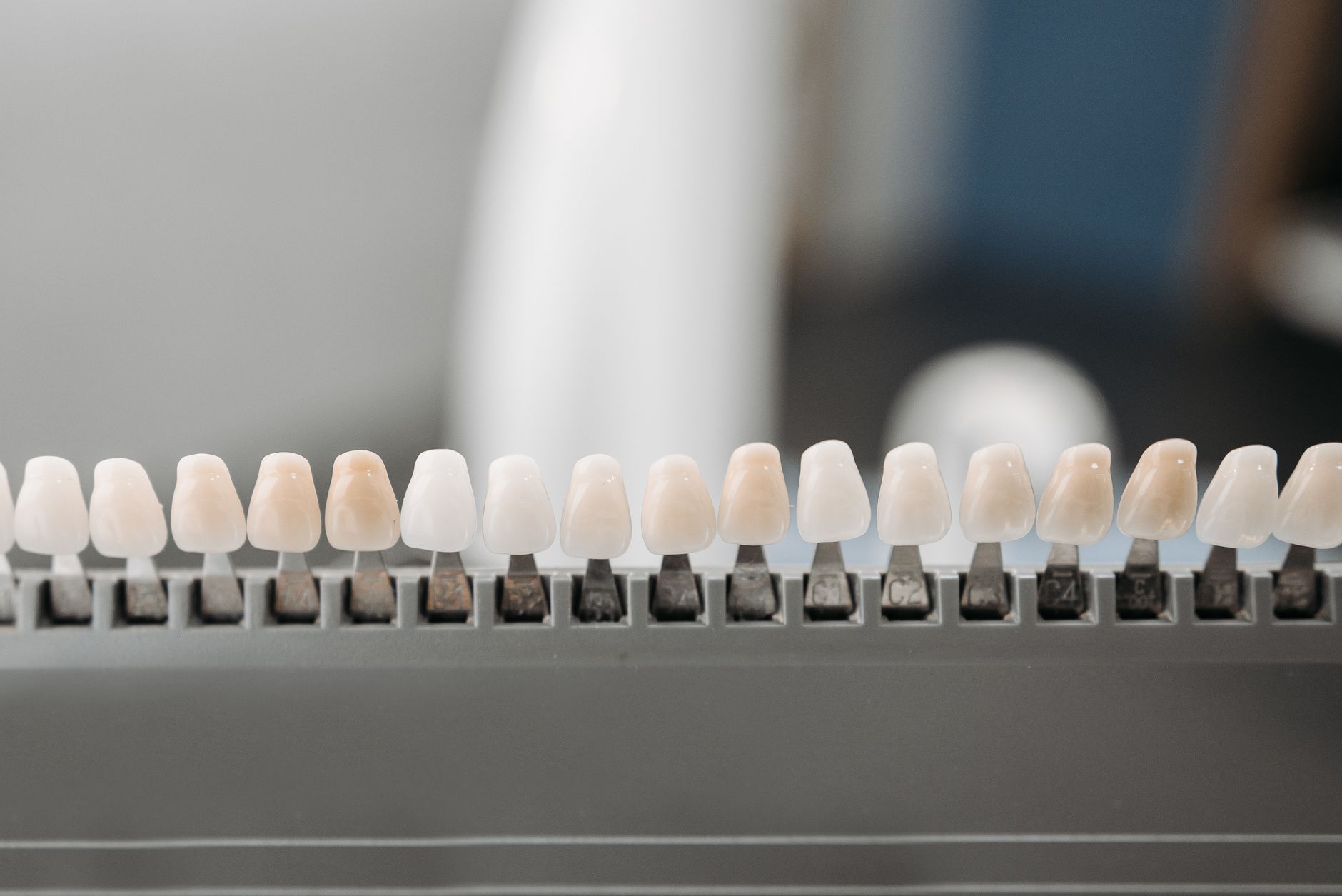Different Types of Dental Veneers and Their Benefits