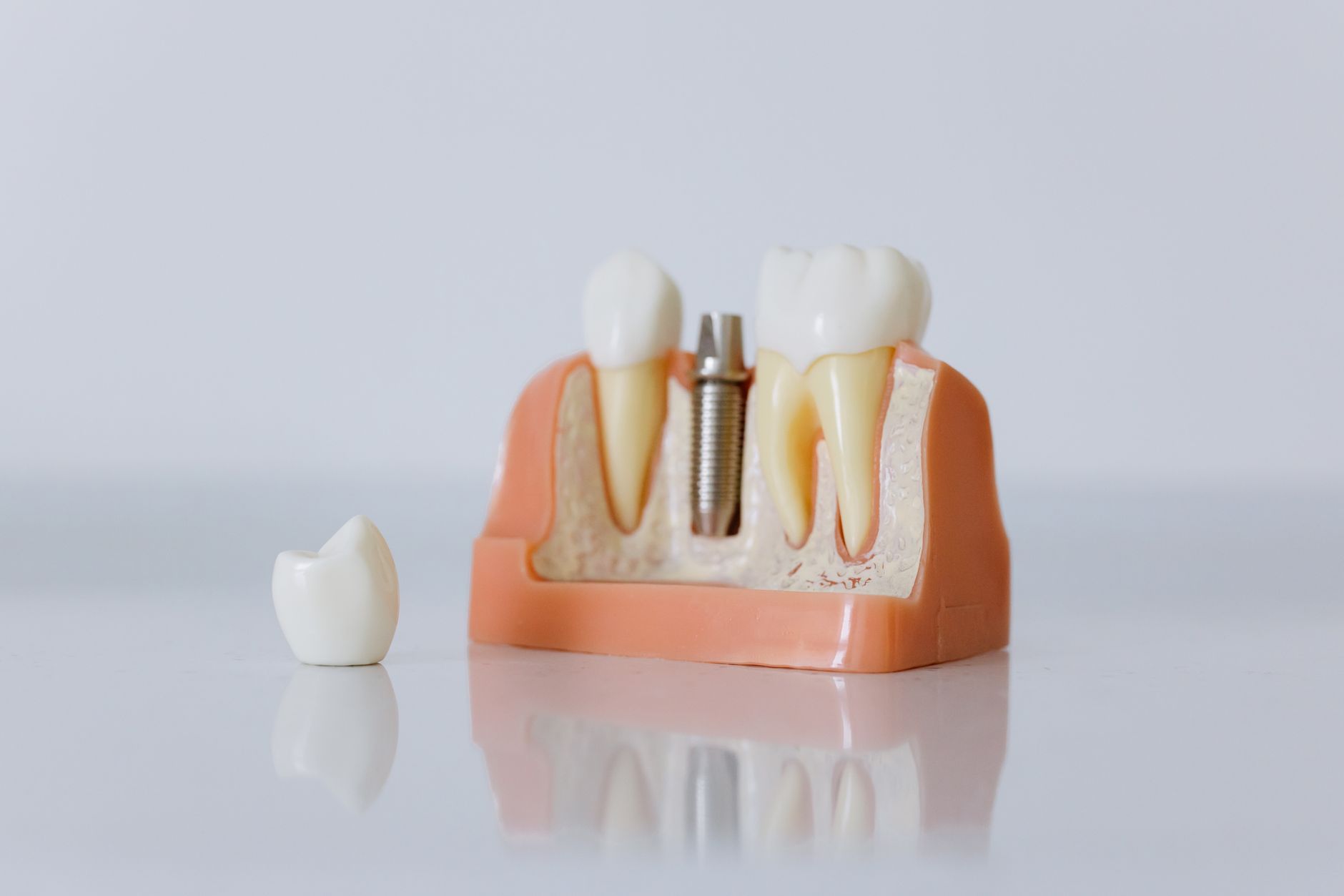 Effective Solutions for Fixing a Missing Tooth