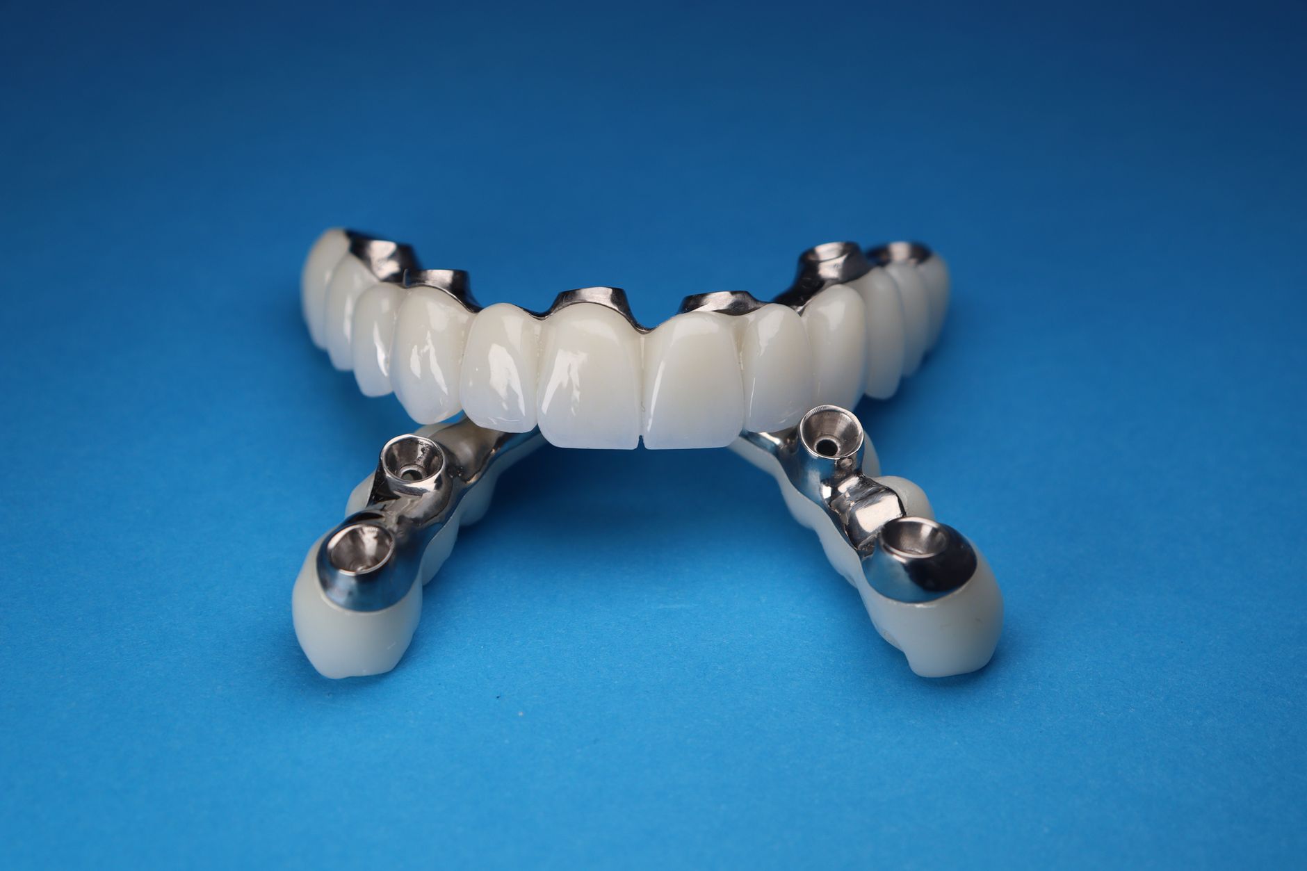 Unlocking the Benefits of Dental Implants: A Comprehensive Guide