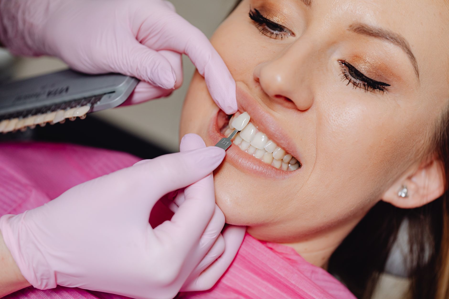 Essential Tips on How to Maintain Your Dental Veneers