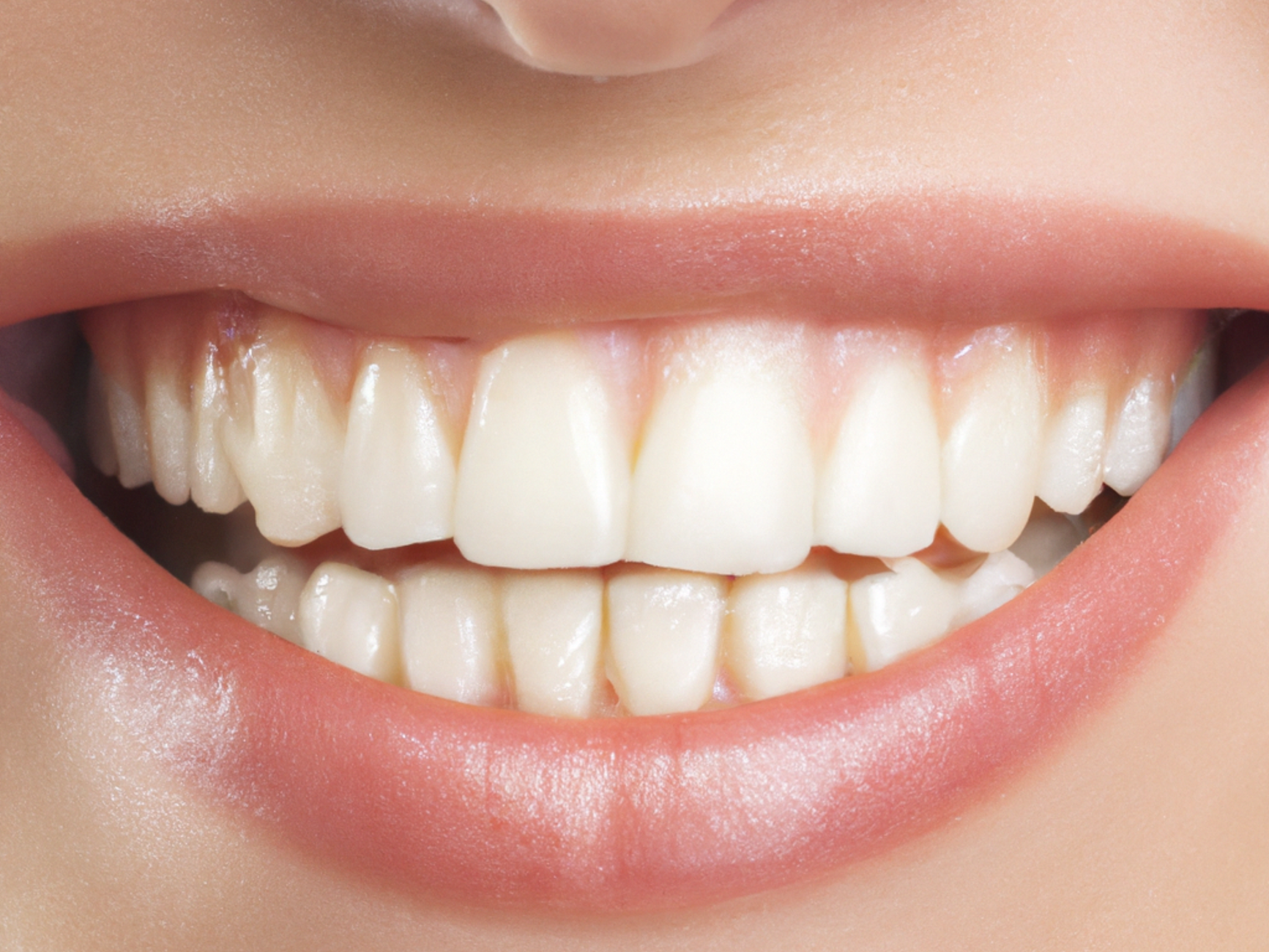 How to Prevent Periodontal Disease: Essential Tips