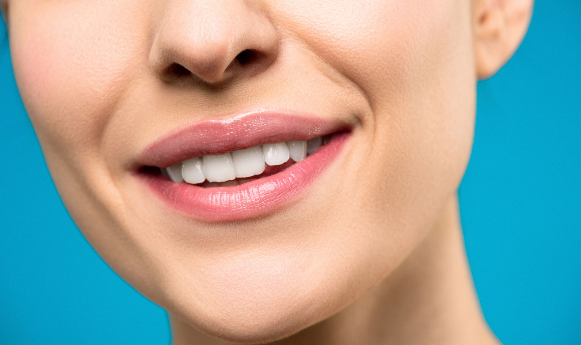 How to Maintain White Teeth After Professional Whitening