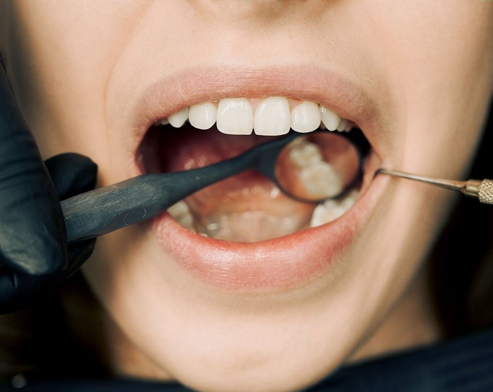 Exploring Effective Gum Disease Treatment Options