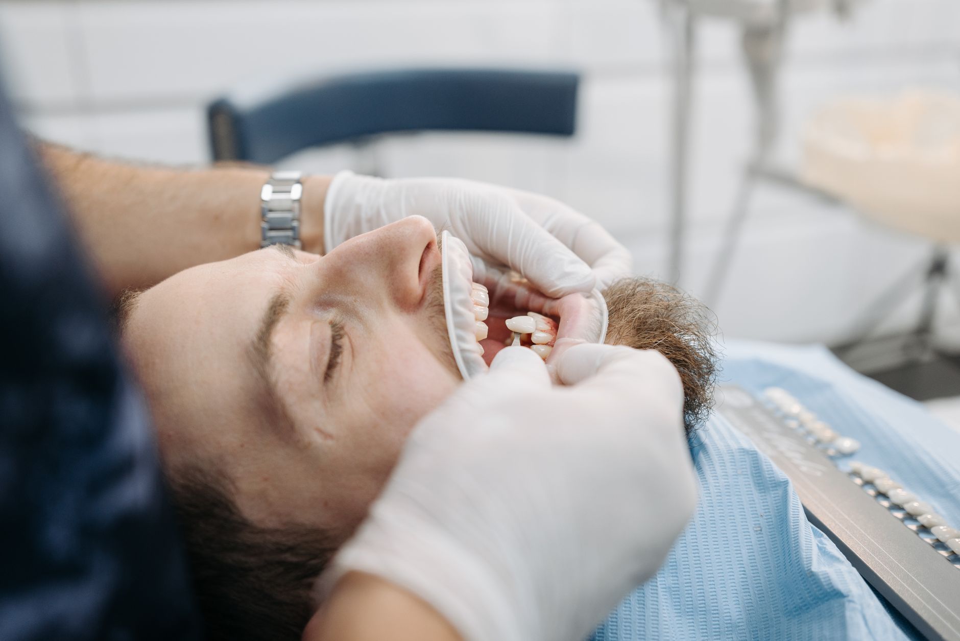 What Are Dental Crowns and When Do You Actually Need One?